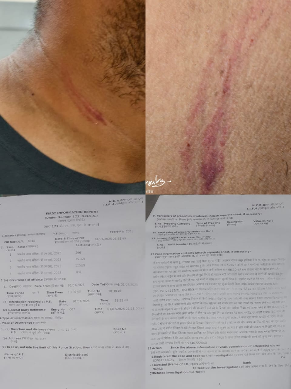 शरेआम पत्रकार पर जानलेवा हमला: गर्दन पर किया वार, ग्रामीणों ने बचाई जान